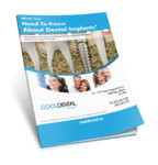 Dental Implant Guide