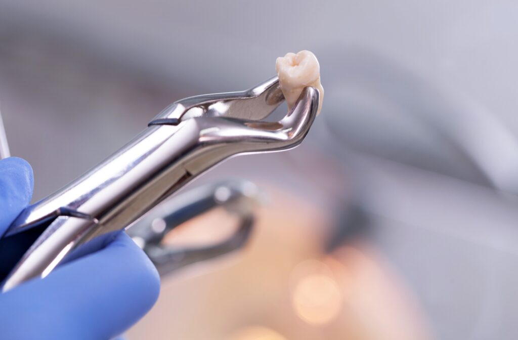 A tooth that has been extracted held in dental forceps