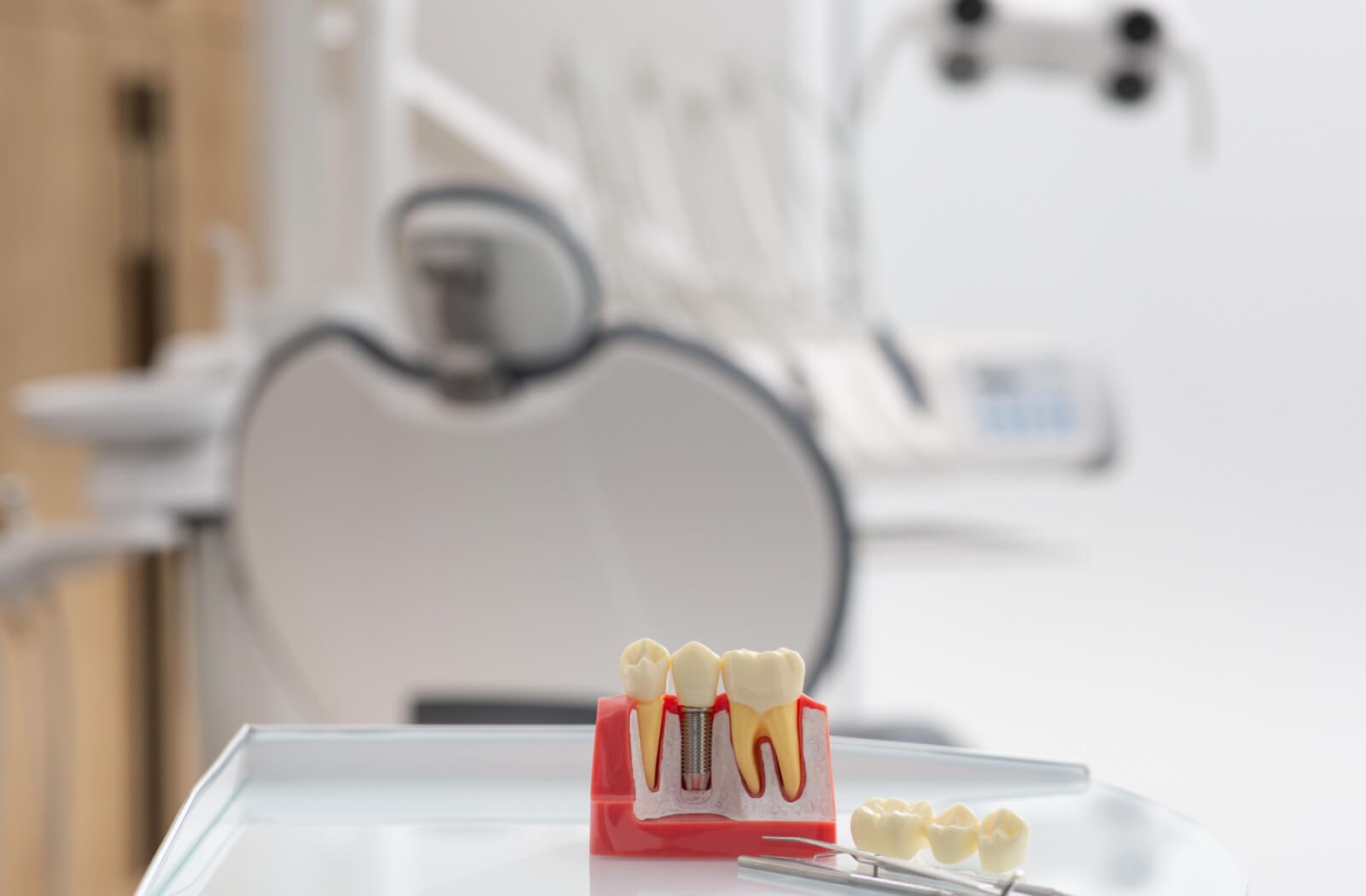 A dental model showing a cross-section of a dental implant and a dental bridge on a tray in a clinical setting, comparing tooth replacement options.